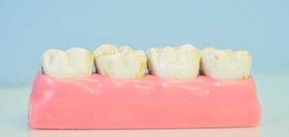 Jak chronić zęby przed próchnicą?